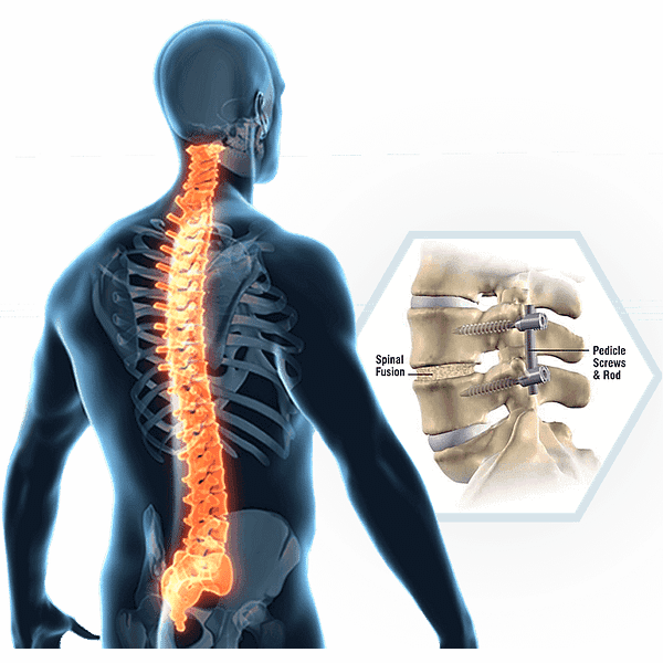 Bone Biologics Corp logo